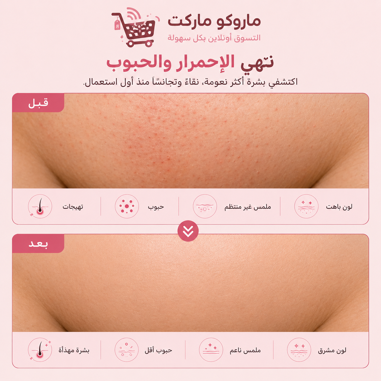 ✨ ماكينة إزالة الشعر النسائية – نعومة مثالية بسهولة - الصورة 3
